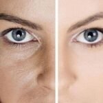 احمي بشرتك من التجاعيد المبكره حتى لو لسه في العشرينات ..!