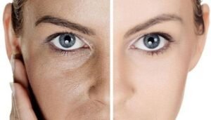 احمي بشرتك من التجاعيد المبكره حتى لو لسه في العشرينات ..!