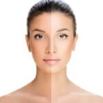 نقص الفيتامينات يسبب اسمرار