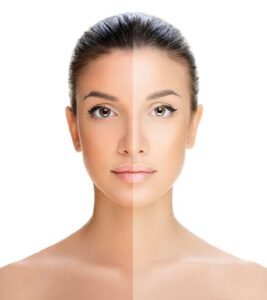 نقص الفيتامينات يسبب اسمرار