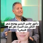 الذقن عند النساء هل هو طبيعي أم مرتبط بتكيس المبايض؟