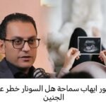 هل السونار خطر على الجنين أثناء الحمل؟ صورة لفحص الموجات فوق الصوتية للجنين